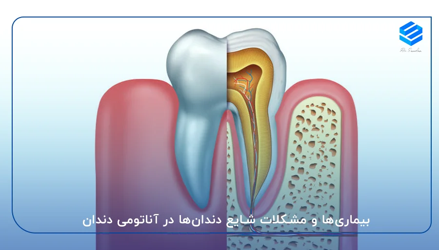 بیماری‌ها و مشکلات شایع دندان‌ها در آناتومی دندان