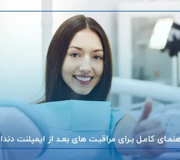 راهنمای کامل برای مراقبت های بعد از ایمپلنت دندان