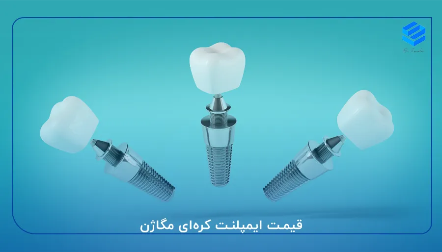قیمت ایمپلنت کره‌ای مگاژن