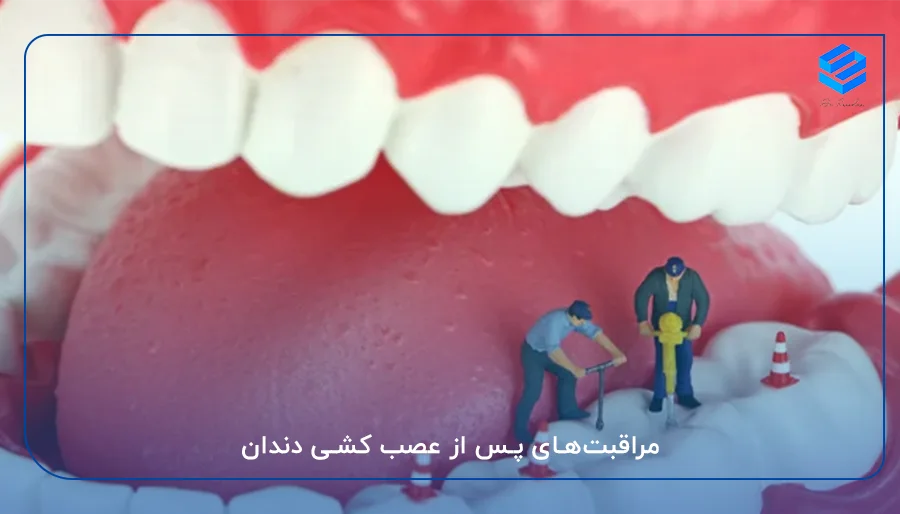 مراقبت‌های پس از عصب کشی دندان