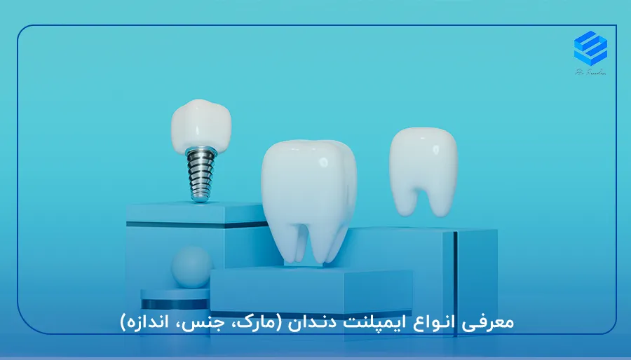معرفی انواع ایمپلنت دندان (مارک، جنس، اندازه)