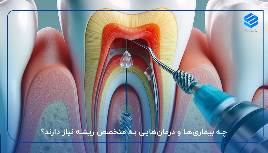 چه بیماری‌ها و درمان‌هایی به متخصص ریشه نیاز دارند؟