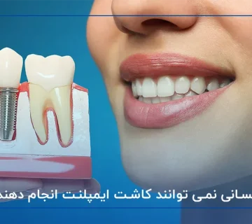 چه کسانی نمی توانند کاشت ایمپلنت انجام دهند