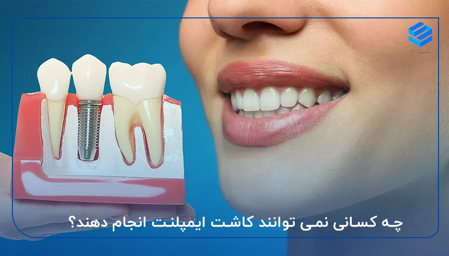 چه کسانی نمی توانند کاشت ایمپلنت انجام دهند