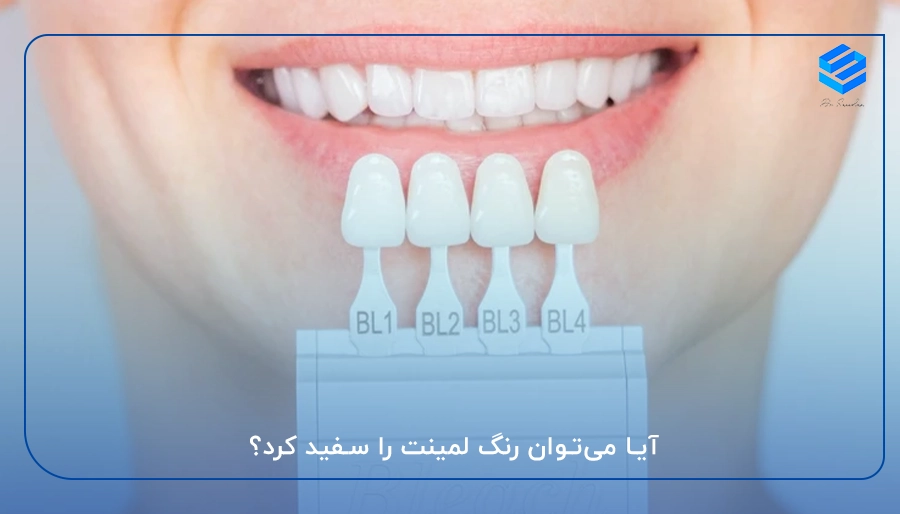 آیا می‌توان رنگ لمینت را سفید کرد؟