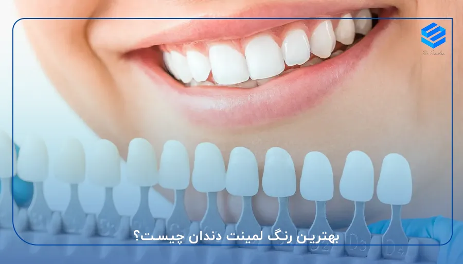 بهترین رنگ لمینت دندان چیست
