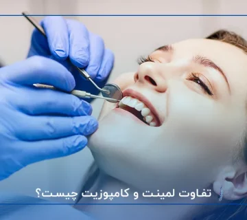 تفاوت لمینت و کامپوزیت چیست؟