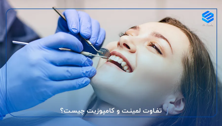 تفاوت لمینت و کامپوزیت چیست؟