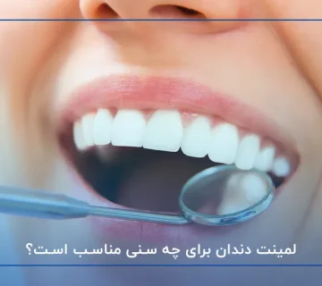 لمینت دندان برای چه سنی مناسب است؟