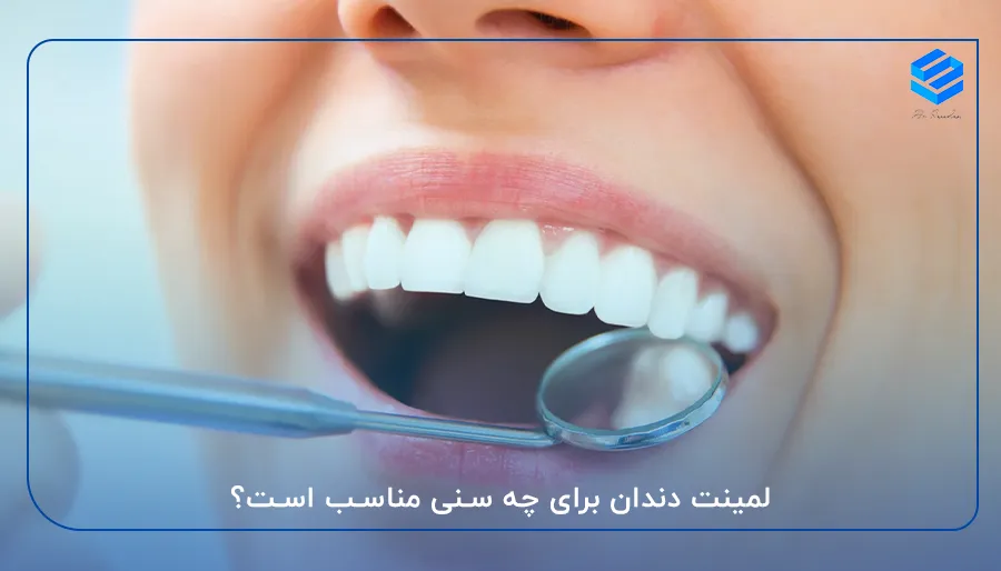 لمینت دندان برای چه سنی مناسب است؟