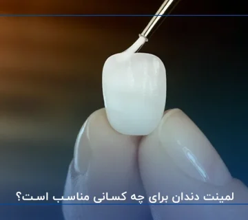 لمینت دندان برای چه کسانی مناسب است؟