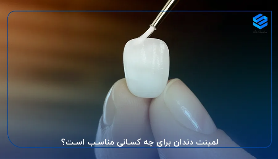 لمینت دندان برای چه کسانی مناسب است؟