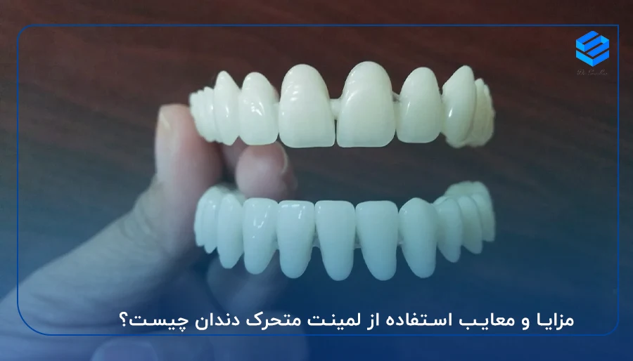 مزایا و معایب لمینت متحرک دندان