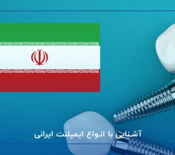 آشنایی با انواع ایمپلنت ایرانی