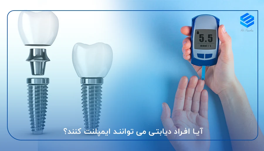 آیا افراد دیابتی می توانند ایمپلنت کنند؟