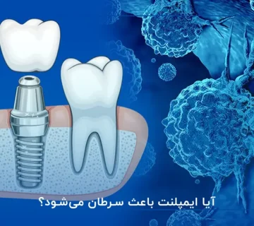 آیا ایمپلنت باعث سرطان می‌شود؟
