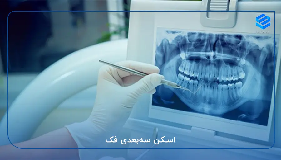 اسکن سه‌بعدی فک