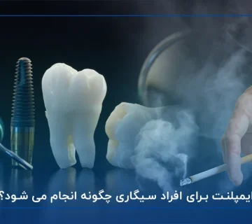 ایمپلنت برای افراد سیگاری چگونه انجام می شود؟