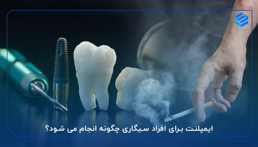 ایمپلنت برای افراد سیگاری چگونه انجام می شود؟