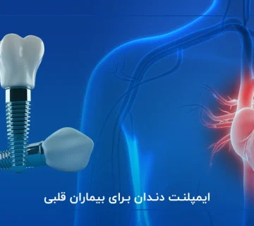 ایمپلنت دندان برای بیماران قلبی