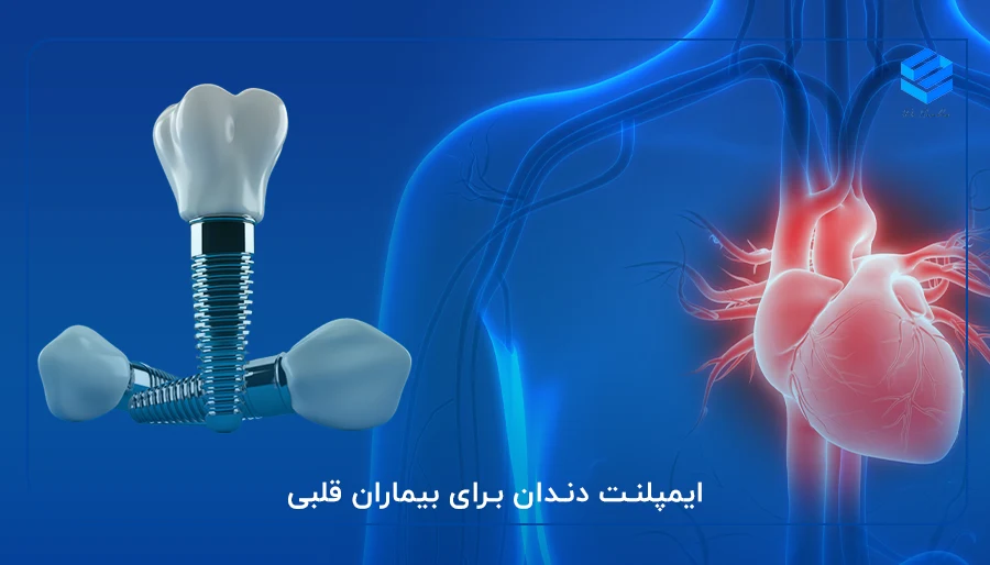 ایمپلنت دندان برای بیماران قلبی