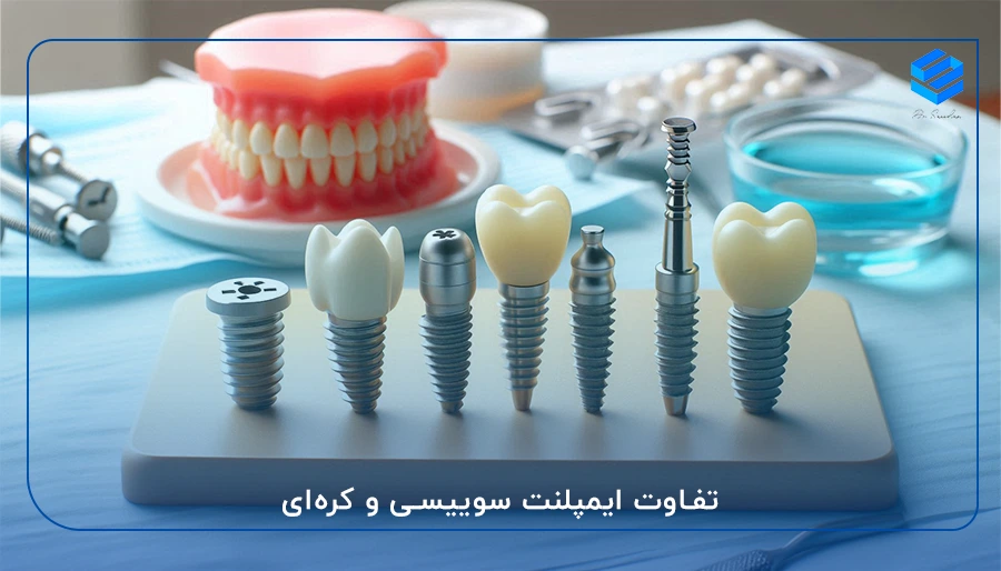 تفاوت ایمپلنت سوییسی و کره‌ای