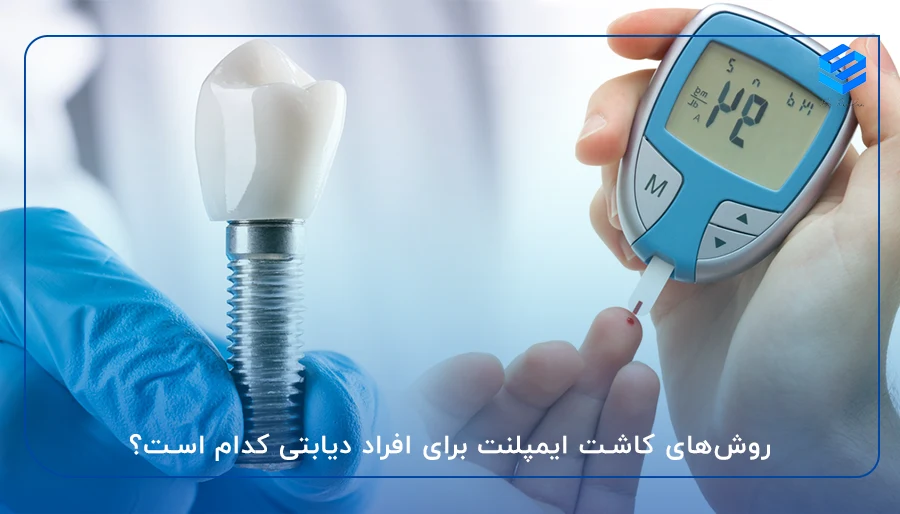 روش‌های کاشت ایمپلنت برای افراد دیابتی کدام است؟
