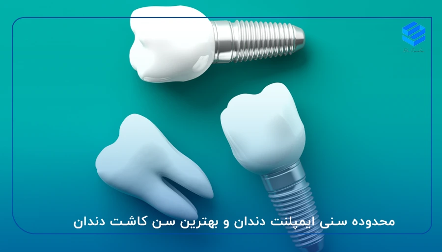 سن مناسب ایمپلنت دندان