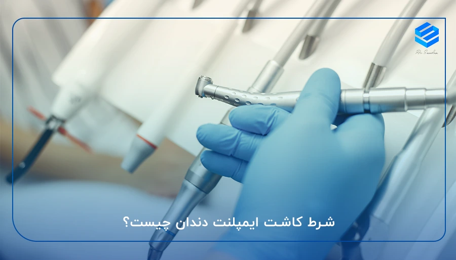 شرایط ایمپلنت دندان