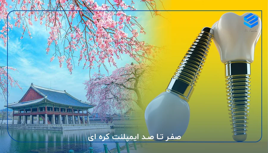 صفر تا صد ایمپلنت کره ای