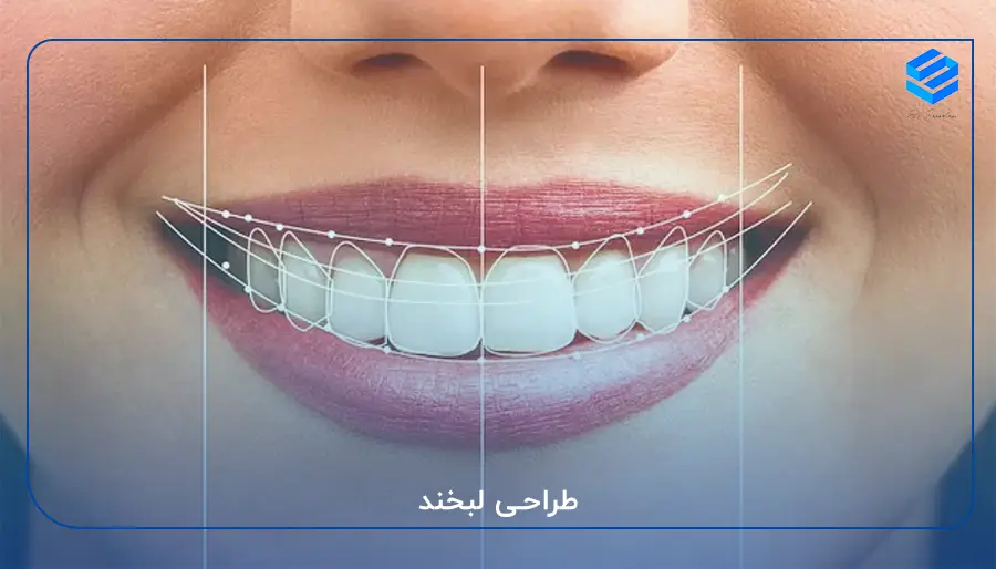 طراحی لبخند