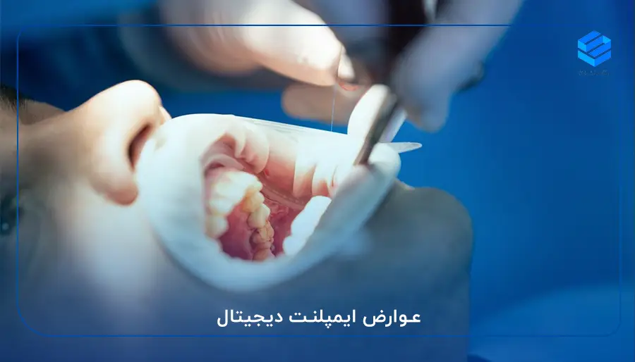 عوارض ایمپلنت دیجیتال