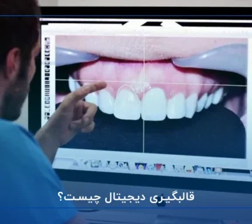 قالبگیری دیجیتال چیست؟