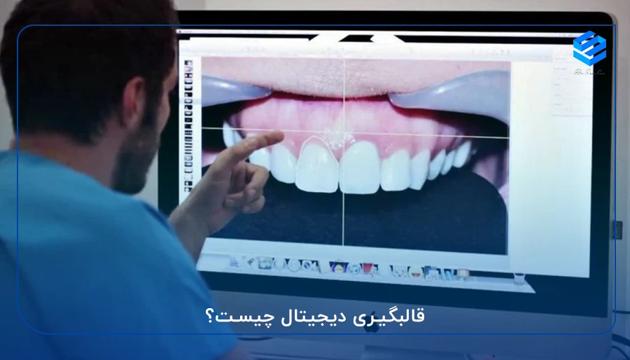 قالبگیری دیجیتال چیست؟