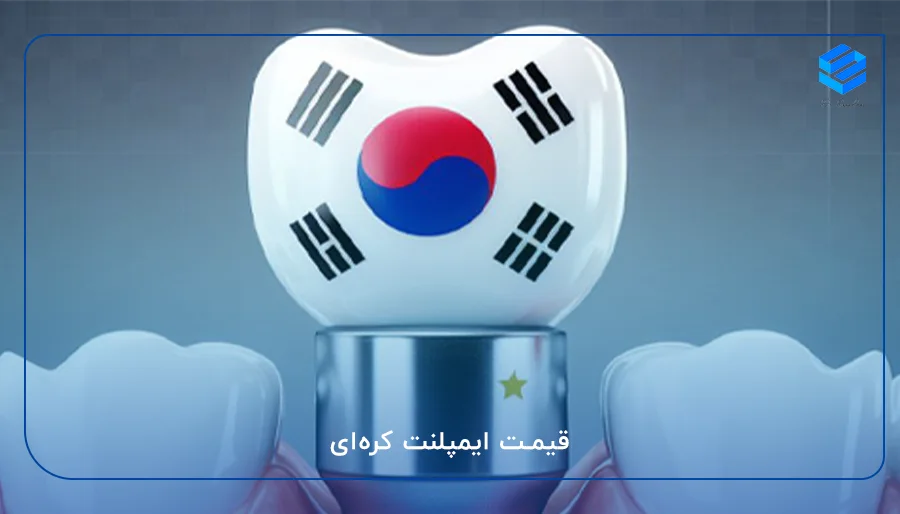 قیمت ایمپلنت کره‌ای