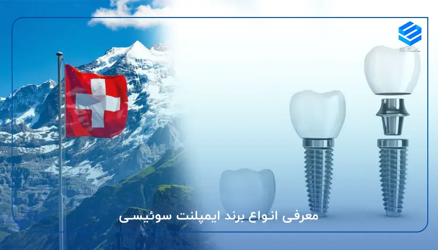معرفی انواع برند ایمپلنت سوئیسی