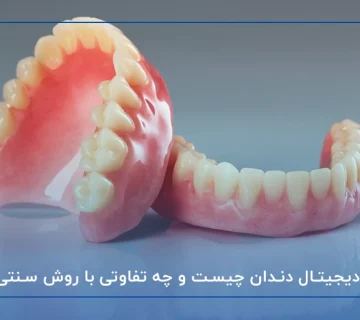 پروتز دیجیتال دندان