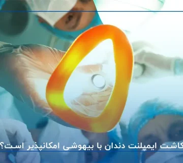 کاشت ایمپلنت دندان با بیهوشی امکانپذیر است؟