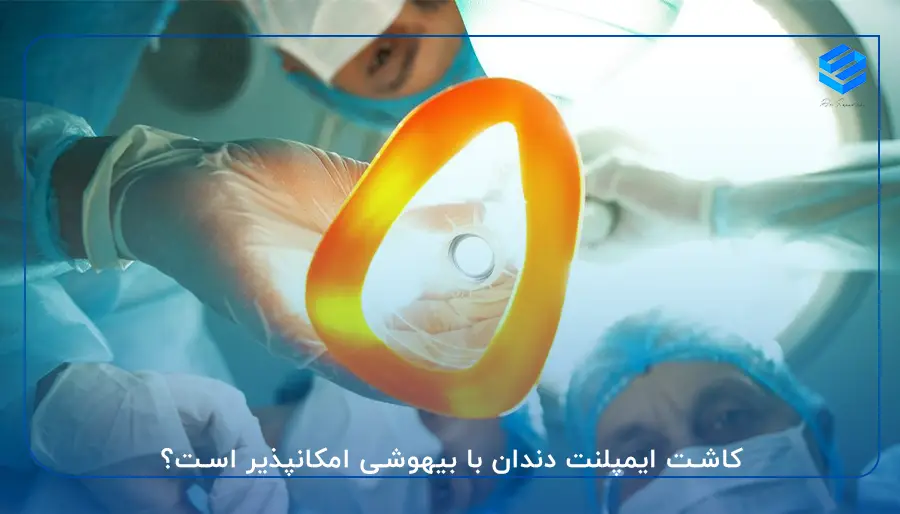 کاشت ایمپلنت دندان با بیهوشی امکانپذیر است؟