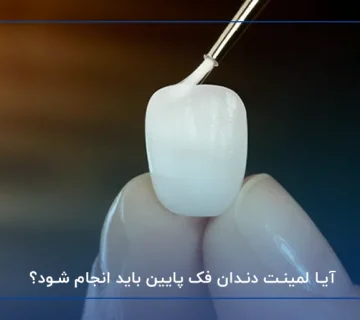 ارتودنسی دندان ایمپلنت شده