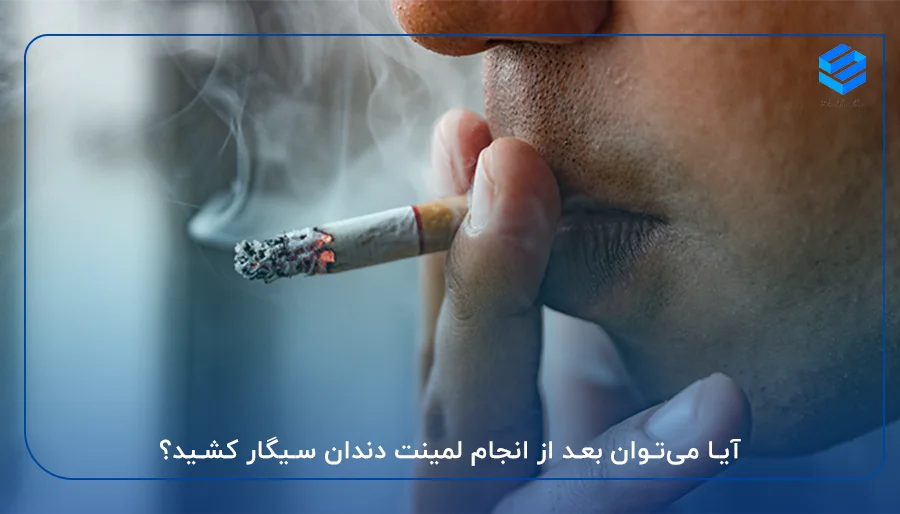 آیا می‌توان بعد از انجام لمینت دندان سیگار کشید؟