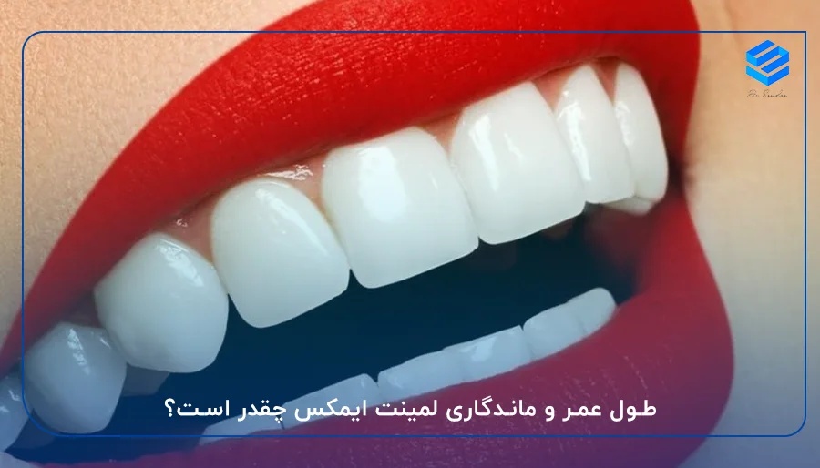 طول عمر و ماندگاری لمینت ایمکس چقدر است؟