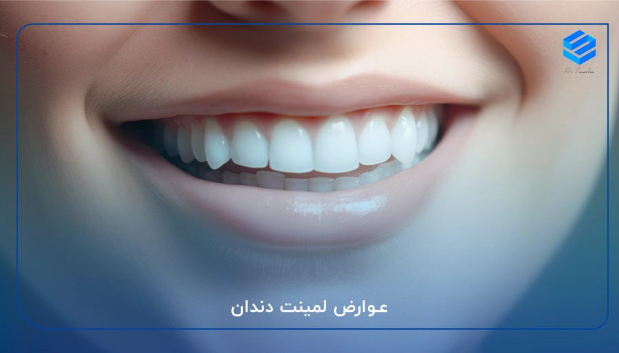 عوارض لمینت دندان
