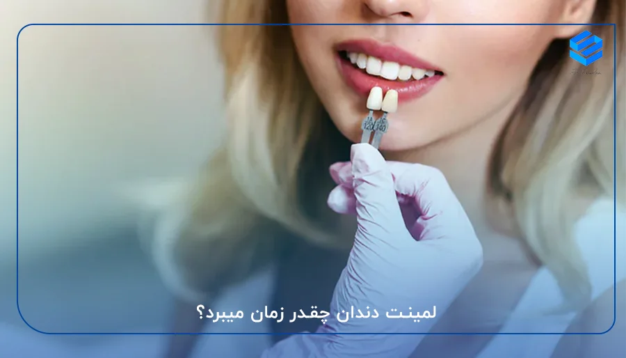 لمینت دندان چقدرطول میکشد؟