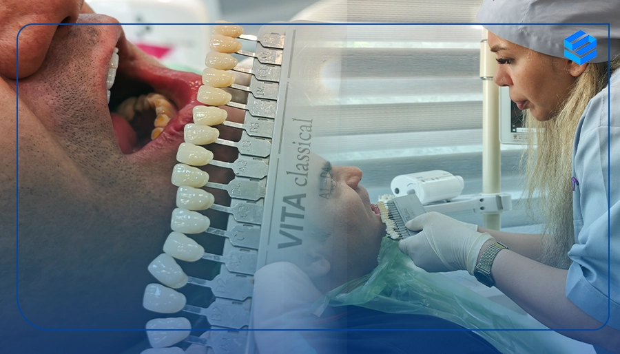 نمونه کار لمینت دندان