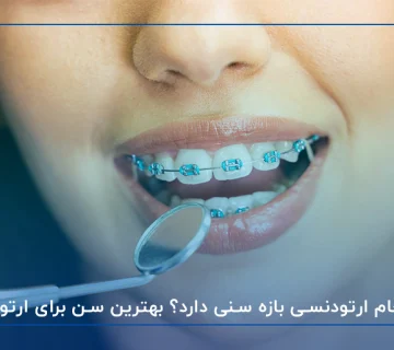 آیا انجام ارتودنسی بازه سنی دارد؟ بهترین سن برای ارتودنسی
