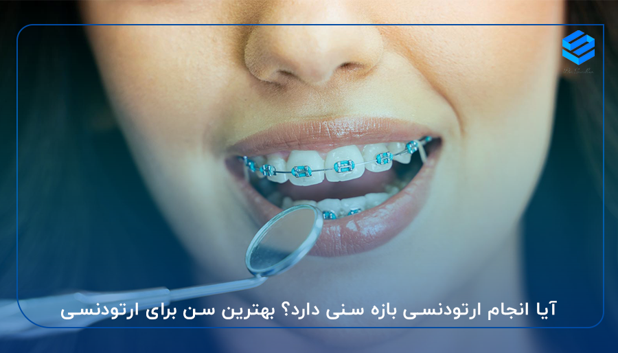 آیا انجام ارتودنسی بازه سنی دارد؟ بهترین سن برای ارتودنسی