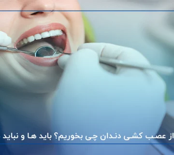 بعد از عصب کشی دندان چی بخوریم؟ باید ها و نباید ها