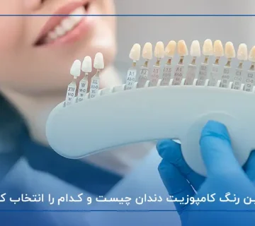 بهترین رنگ کامپوزیت دندان چیست و کدام را انتخاب کنیم؟