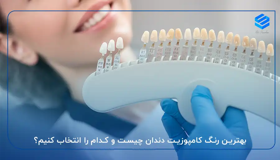 بهترین رنگ کامپوزیت دندان چیست و کدام را انتخاب کنیم؟